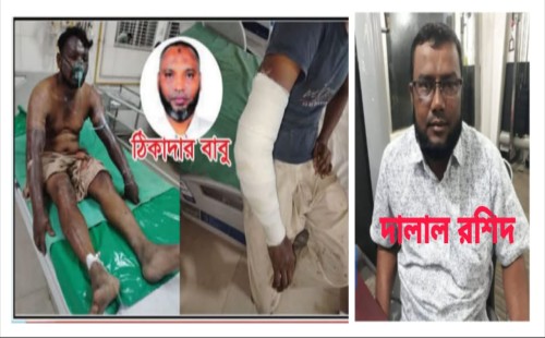 খিলক্ষেতে অবৈধভাবে তিতাস গ্যাস সংযোগ বিচ্ছিন্নের সময় বিস্ফোরণ, আহত ২ 